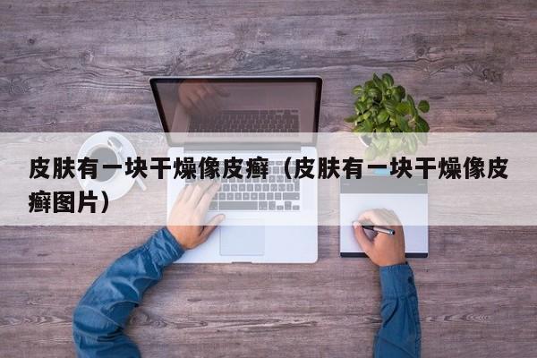皮肤有一块干燥像皮癣（皮肤有一块干燥像皮癣图片）
